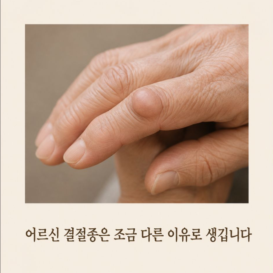 어르신 결절종은 다른 이유로 생깁니다
