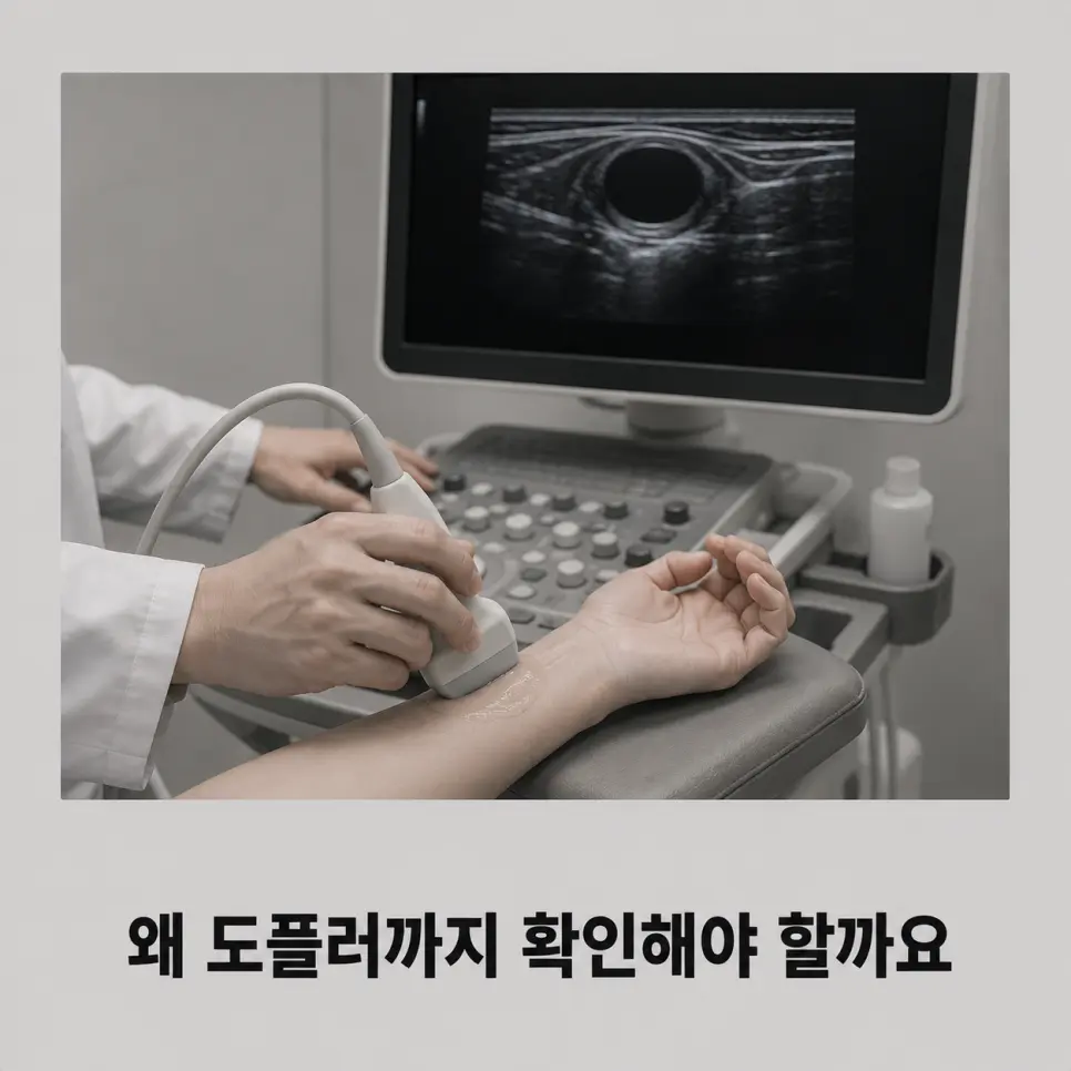 혈류가 없는 전형적인 결절종 초음파