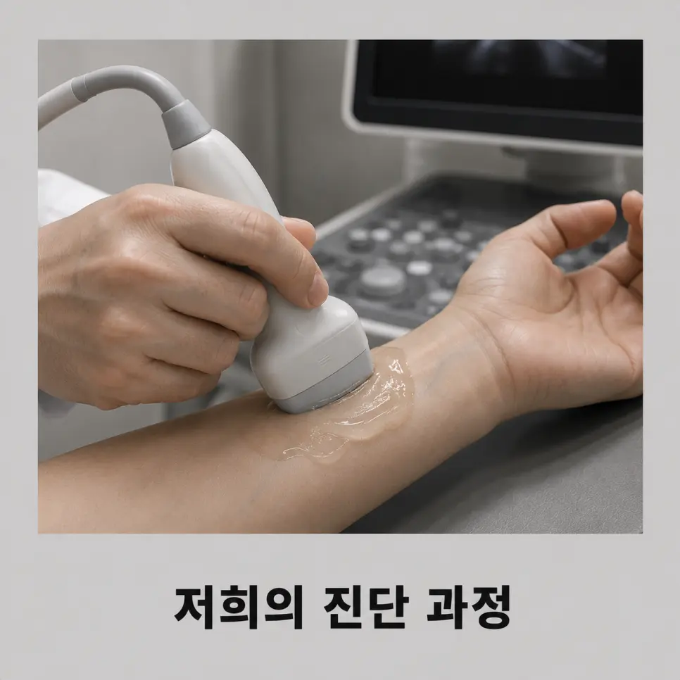 결절종 초음파 감별 진단 과정