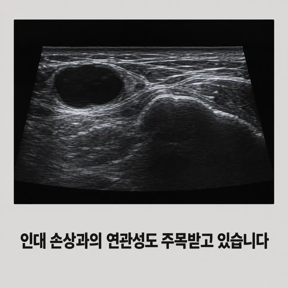 체조 선수의 손목 결절종 위험